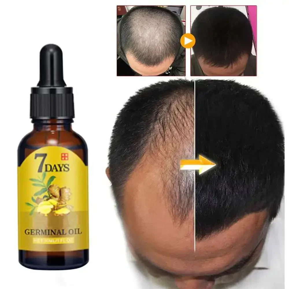 Ingrown Hair Serum - Crescimento do cabelo gengibre rápido crescimento