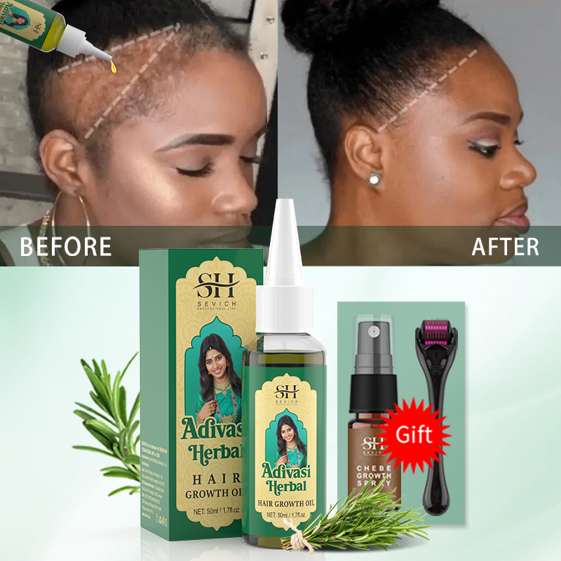 Óleo Ayurvédico para Crescimen - Ingrown Hair Serum avaliação e preço