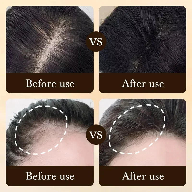 Óleo de Crescimento Rápido de  - Ingrown Hair Serum avaliação e preço