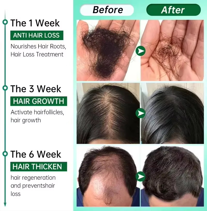 Sérum para Crescimento Capilar - Ingrown Hair Serum avaliação e preço