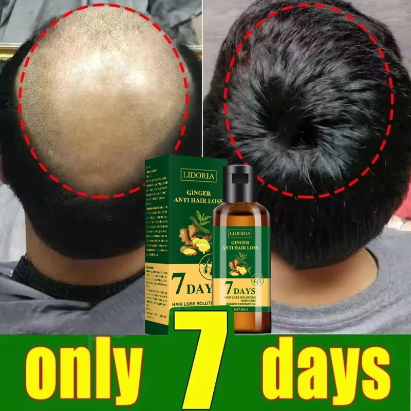 Sérum para Crescimento Capilar - Ingrown Hair Serum avaliação e preço