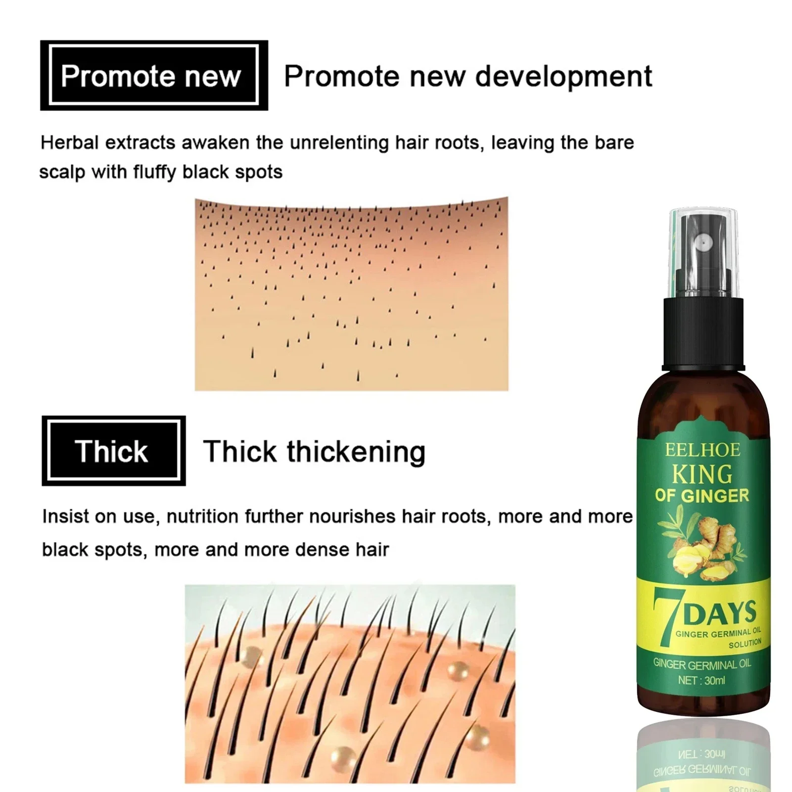 Pulverizador do soro do cresci - Ingrown Hair Serum avaliação e preço